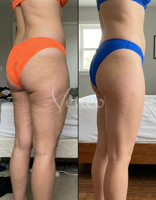 R&eacute;sultat cliente